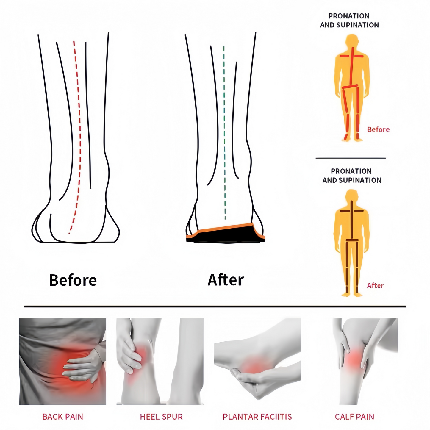 Moldable Arch Support Insoles